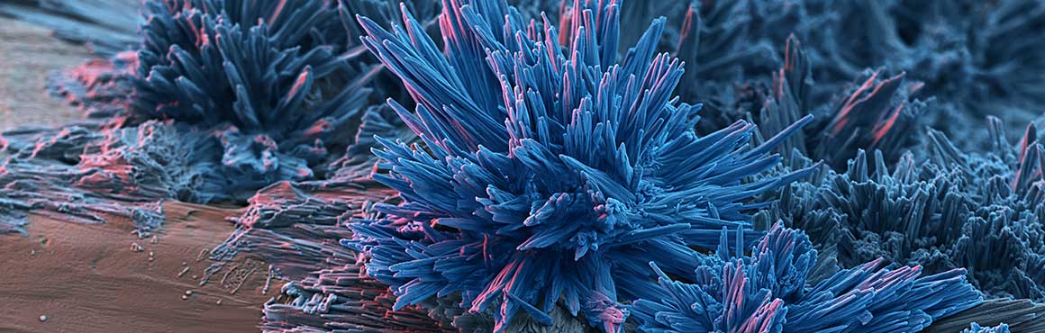 Raster-Elektronenmikroskopische Aufnahme von Coffein-Kristallen (blau koloriert)